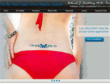 Tablet Screenshot of bayarealasertattooremoval.com